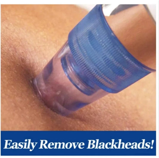 Pore Cleaning Device – Deep Pore Facial Cleanser & Blackhead Remover